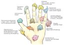 Hand