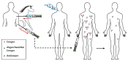 passive Immunisierung