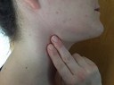 Pulsmessung Hals