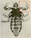 Kopflaus