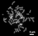 Chromosomen